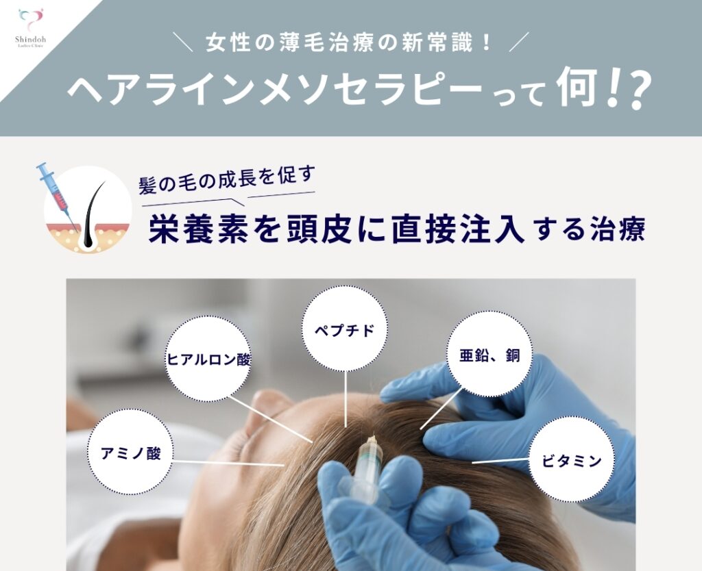 産後の薄毛にオススメのヘアラインメソセラピーとは??