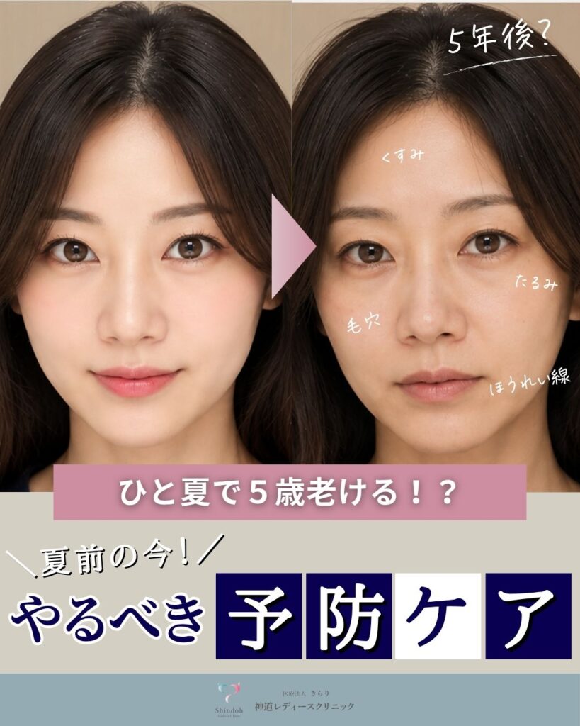 神道レディースクリニックが教える【夏老けを防ぐ】予防ケア🪞✨