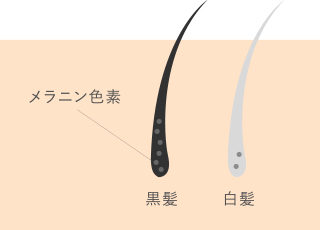 白髪について
