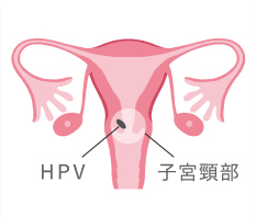 子宮頸部 HPV